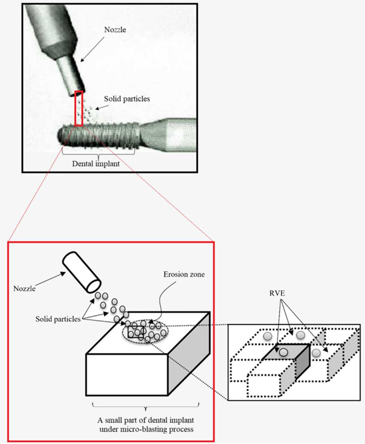 dental implant parts diagram